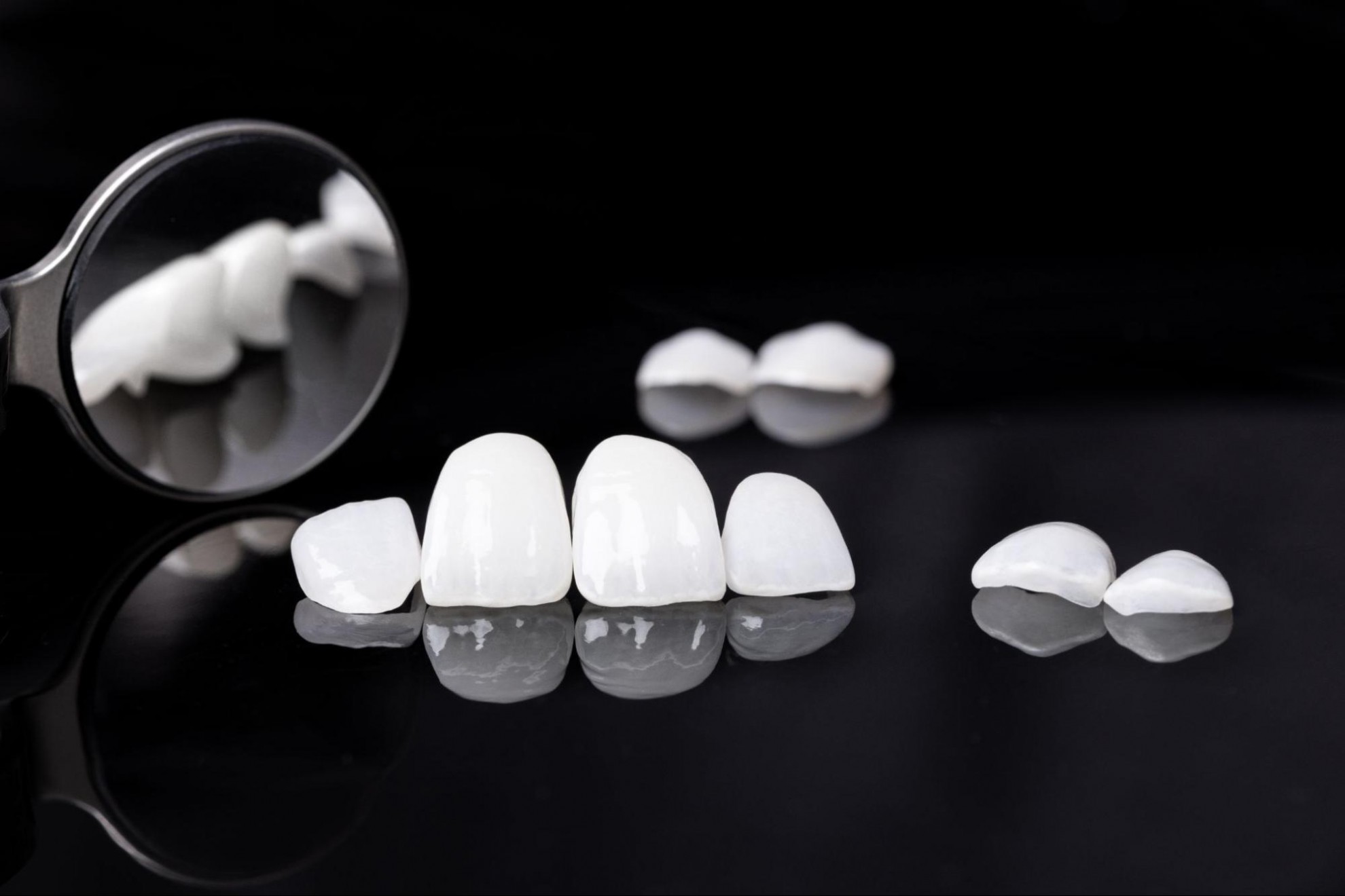 牙冠是什麼?3種材質比一比,打造專屬微笑曲線這樣選! 牙冠價格依材質不同而有落差