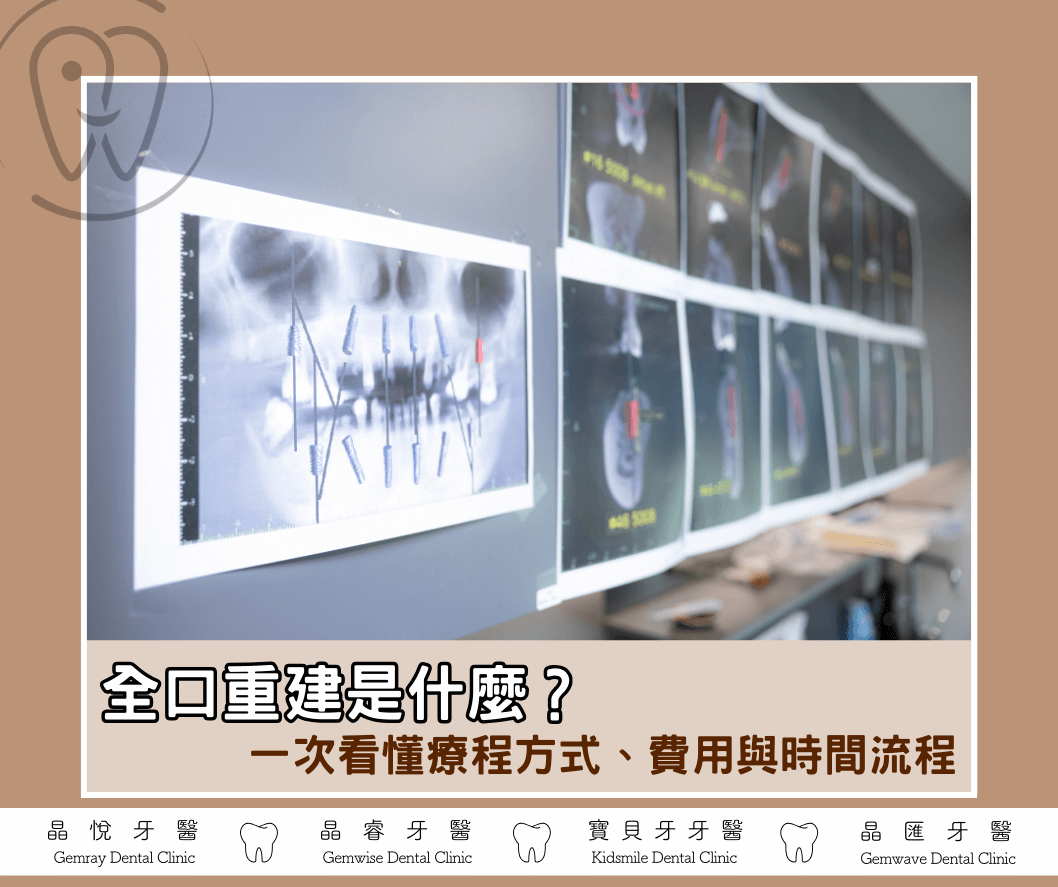 全口重建幫助重建口腔健康 全口重建幫助重建口腔健康