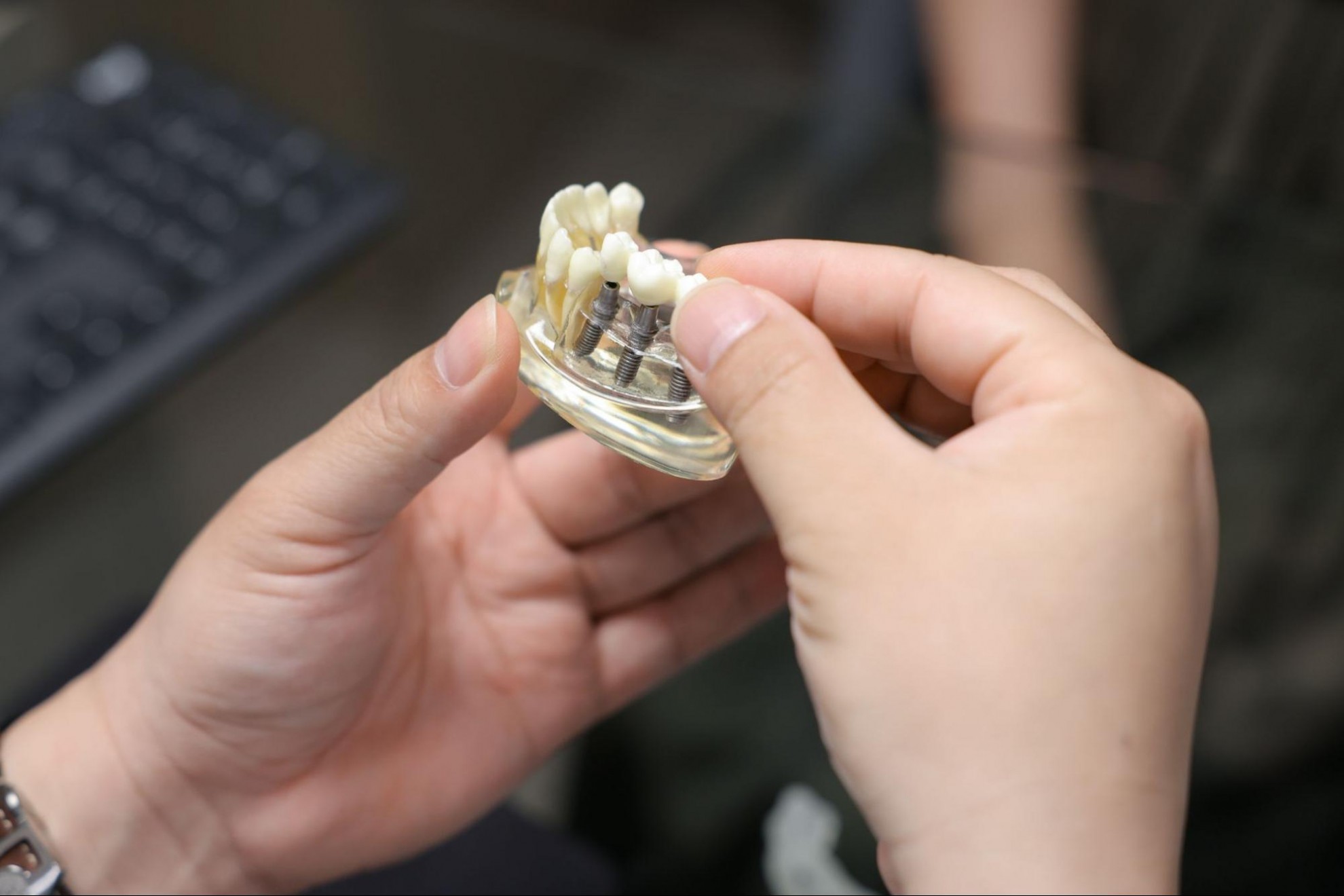 牙周病植牙要注意什麼?一次看懂治療流程與術後注意事項 掌握3個牙周病植牙術後注意事項