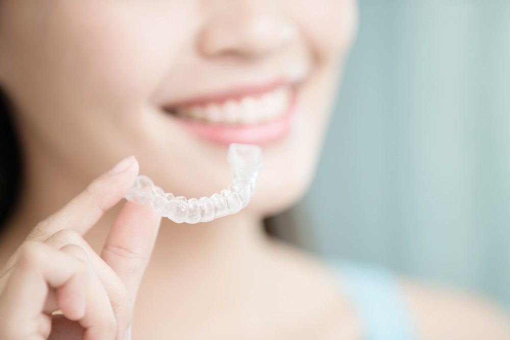 維持器要戴多久?多久換一副?一篇看懂維持器配戴重點 維持器要戴多久?維持器配戴時間說明